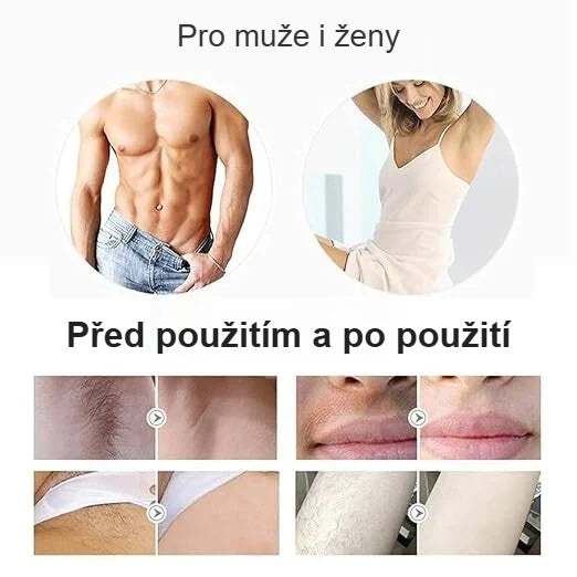 IPL epilátor pro muže i ženy, ošetřené partie před a po