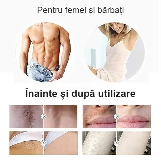 Epilator IPL pentru bărbați și femei, zone tratate înainte și după